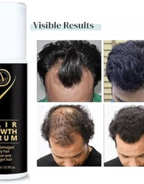 Hair Growth Serum